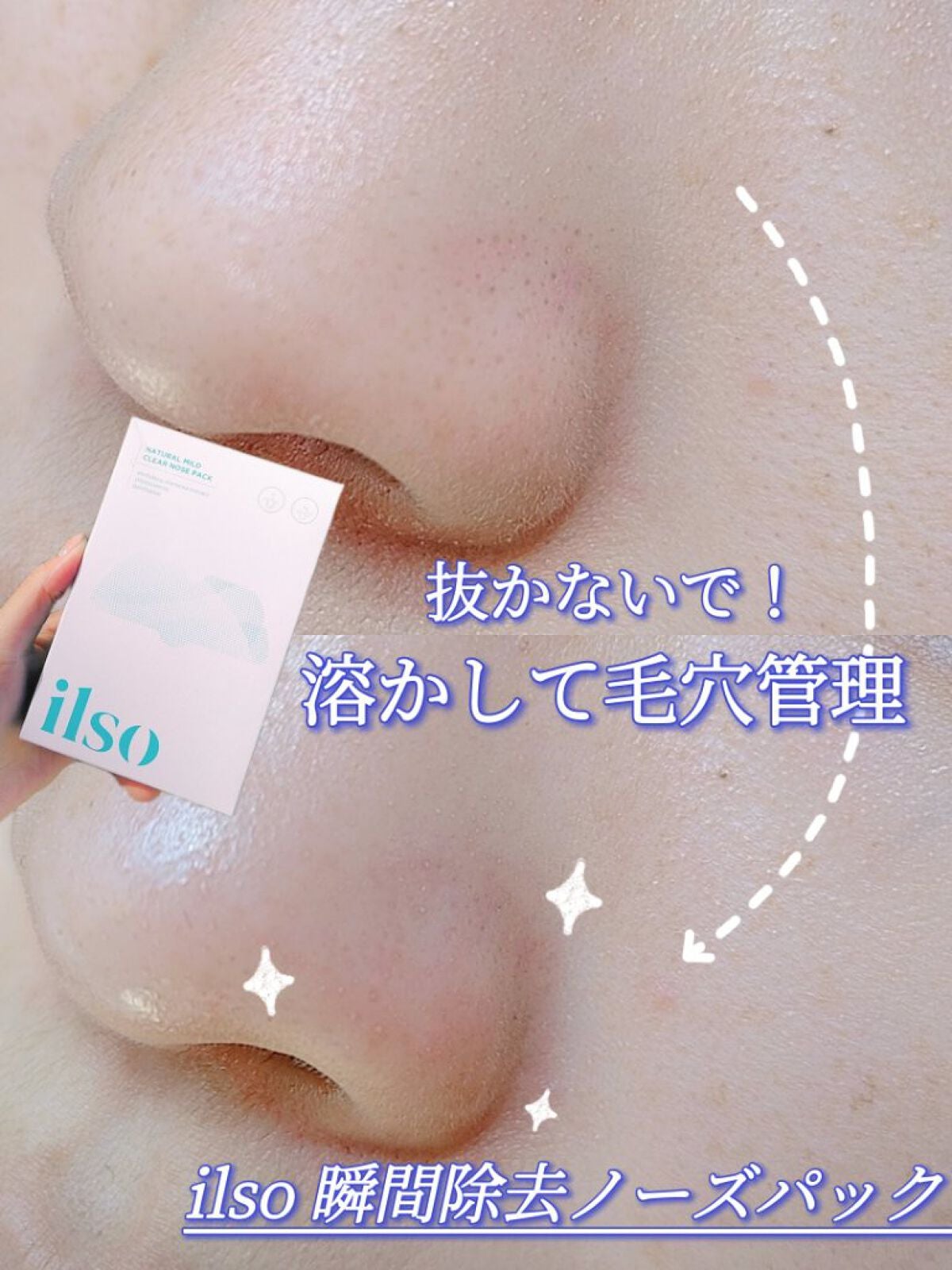 ナチュラルマイルドクリアノーズパック/ilso/シートマスク・パックを使ったクチコミ(1枚目)