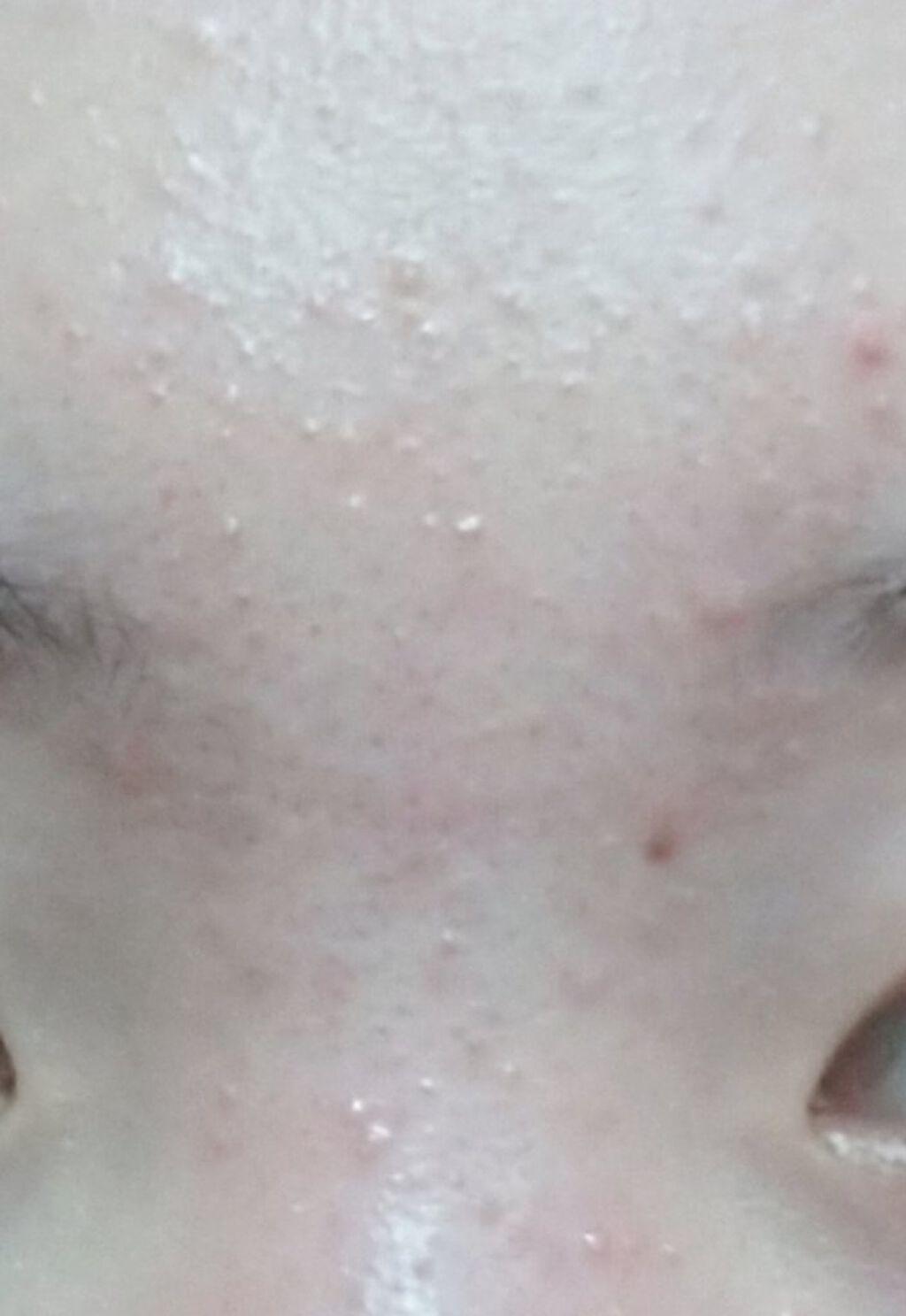 チョコラBBピュア (医薬品)/チョコラBB/その他を使ったクチコミ（3枚目）