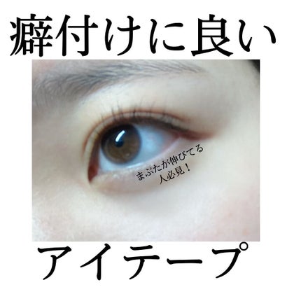 理想のふたえ くっきりクセづけ クリアワイド/セリア/二重まぶた用アイテムを使ったクチコミ(1枚目)