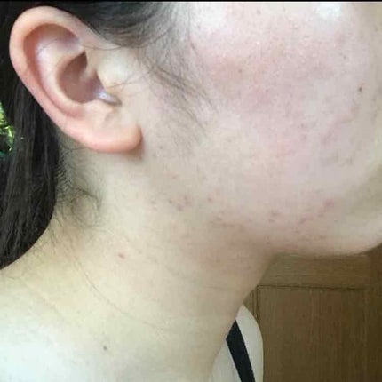 を使ったクチコミ(2枚目)