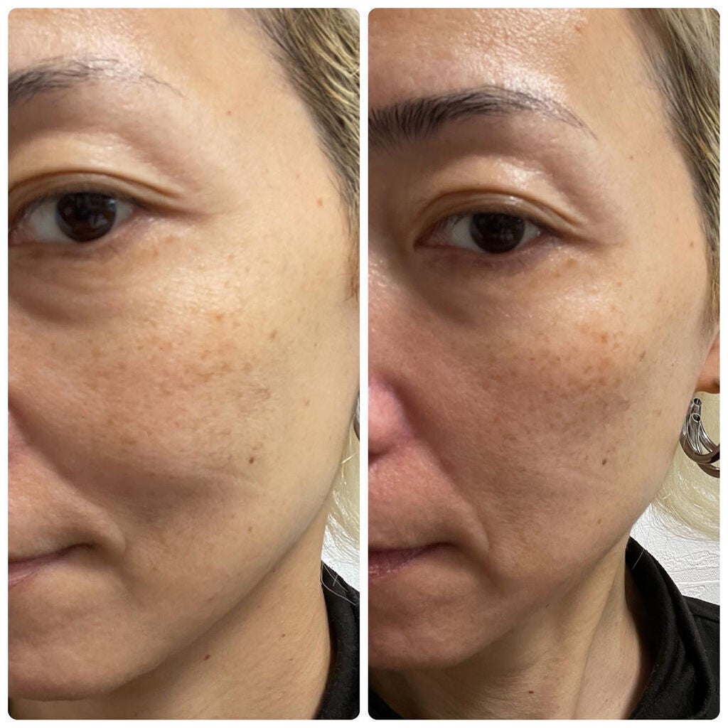 オーバーナイト ヴェールクリーム/BRIGHTAGE/フェイスクリームを使ったクチコミ(6枚目)