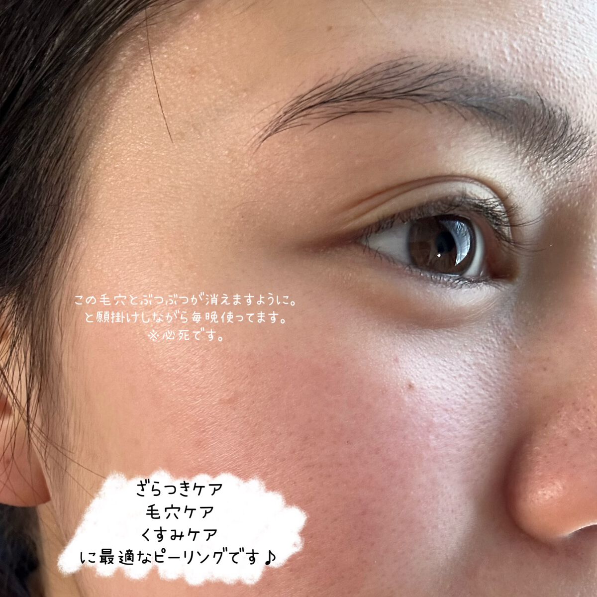 原液ピーリング液/TUNEMAKERS/拭き取り化粧水を使ったクチコミ（2枚目）