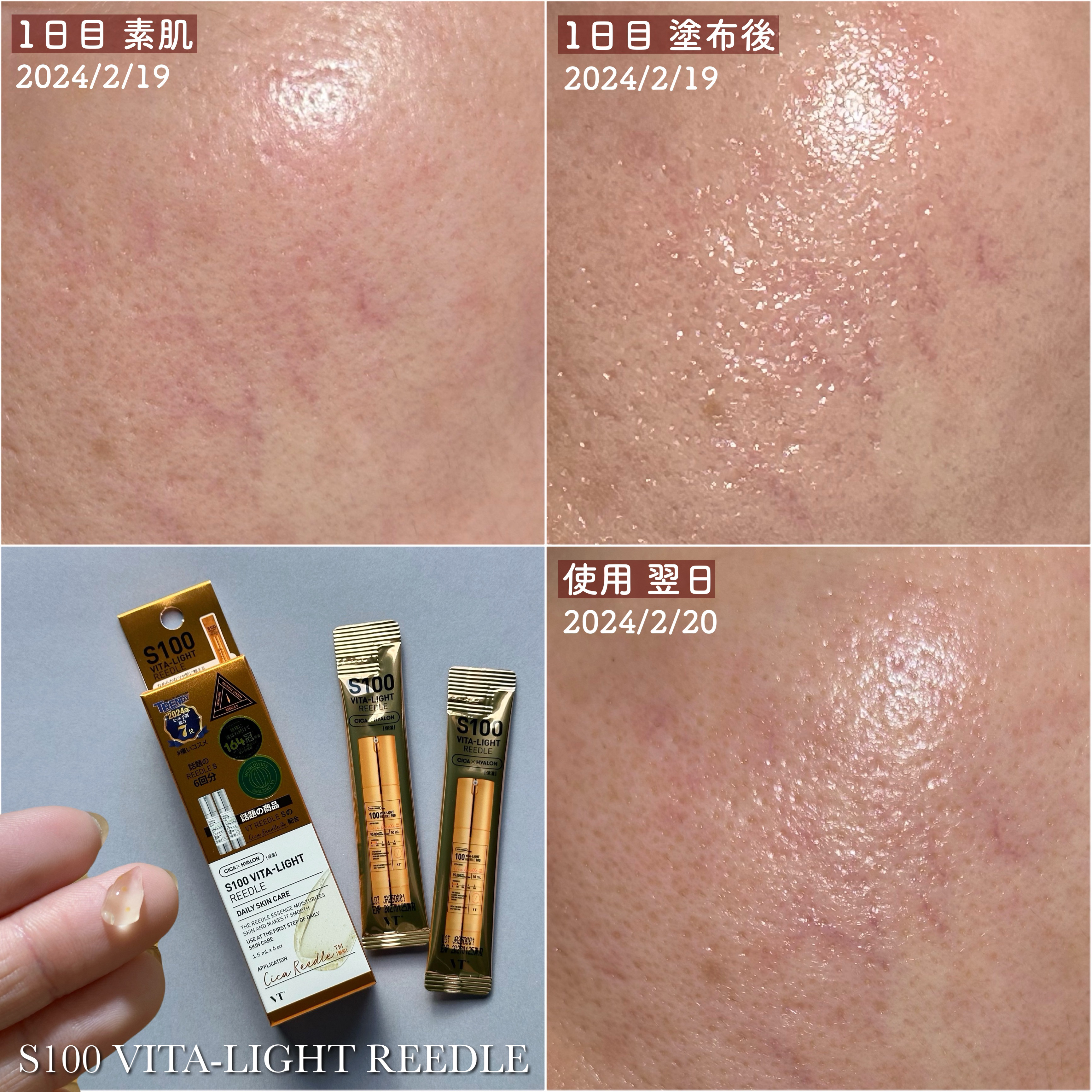 リードルS 100 2ステップマスク/VT/シートマスク・パックを使ったクチコミ（2枚目）