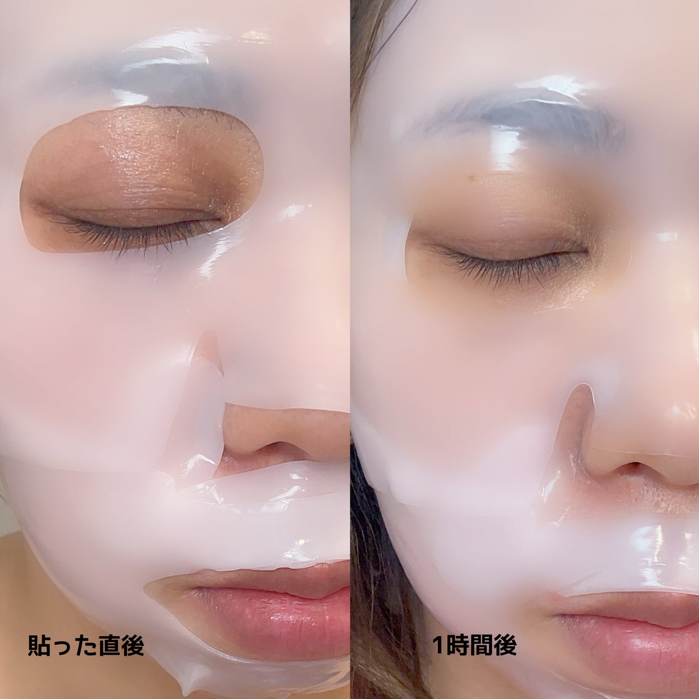 プロCICAリードルS 100 2ステップハイドロゲルマスク/VT/シートマスク・パックを使ったクチコミ(7枚目)