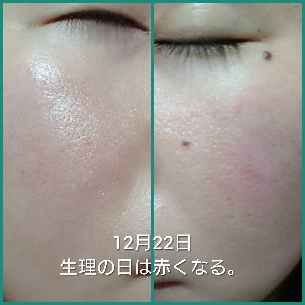 菊正宗 日本酒の化粧水 高保湿/菊正宗/化粧水を使ったクチコミ（1枚目）