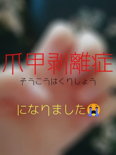 時々爪を休める期間を与えつつ、2年程ジェルネイルをしていたところ……


「爪甲剥離症」になりました😭😭😭😭


爪甲剥離症(そうこうはくりしょう)とは、爪の白い部分が広くなる…つまり皮膚から爪が剥がれる病気です。

原因は外的損傷やカビ、ネイル等様々。
私の場合、皮膚科で診てもらったらカビ菌は無かったのでネイルが原因ではないかと。

🔻私の爪のスペック
めっちゃ薄い
柔らかい
二枚爪になりやすい
すぐ割れる

と、ダメージを受けやすい爪です。

オフする際の力加減を間違えると剥がれたり、
爪に塗ったジェルを硬化すると多少ジェルが縮むそうで、その時に爪が剥がれることがあるらしいです。
私の場合痛さはありませんが、カビ等が原因でなった場合は痛みもあるかもしれません。

皮膚科の先生曰く「一時的なものだと思うからネイルはしても大丈夫」との事で、症状も軽度なので深刻に思う必要はないのかもしれませんが…万が一悪化して、爪が白くなったの考えるとゾッとして🙀
今はネイルを我慢して、治療に専念することにしました✊🏻✨

手は極力濡らさず保湿することが大事みたいなので、
病院ではワセリンを処方して貰いました。
だがしかしワセリンなので1回塗ると手がベタベタになるのが難点｡ﾟ(ﾟ＾ω＾ﾟ)ﾟ｡
おかげでせっかく処方してもらったワセリンをついつい塗り忘れてしまうように…。。

そこで😊

根気よく治療を続ける為に、こちらに途中経過を定期的に更新させてください✊🏻

①塗るとベタベタになるので、ワセリンは寝る前に塗る
②それ以外の時はベタつきの少ないネイルオイルで保湿
③長い爪は良くないそうなので、短さをキープ

ひとまず↑のやり方でやってみようと思います◎

使うネイルオイルはフィアンセの有名なやつで💫
これで爪と一緒にささくれもケア出来るはず。

100%自分のための投稿ですが根気よく頑張ります🙌🏻

#爪甲剥離症治すマンの画像 その0