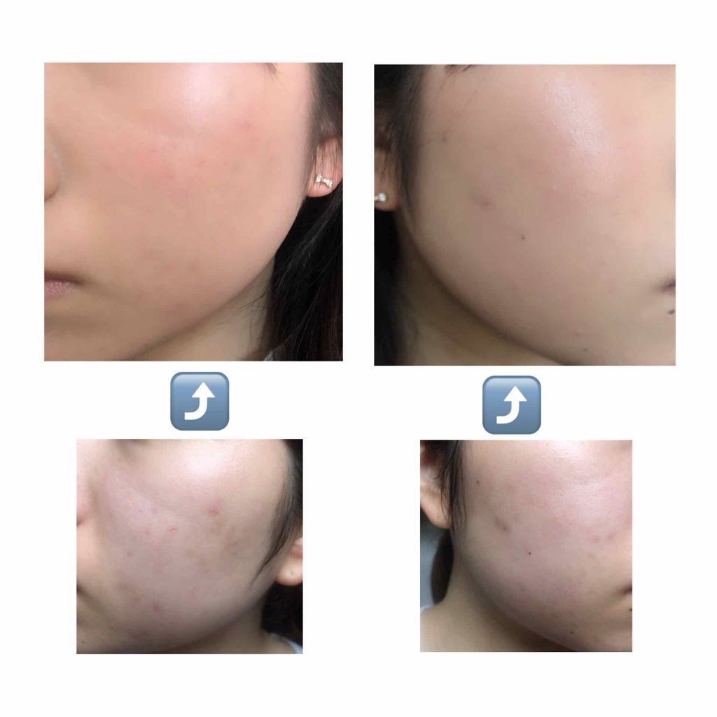 資生堂ベビーパウダー(プレスド)/ベビー/ボディパウダーを使ったクチコミ(2枚目)