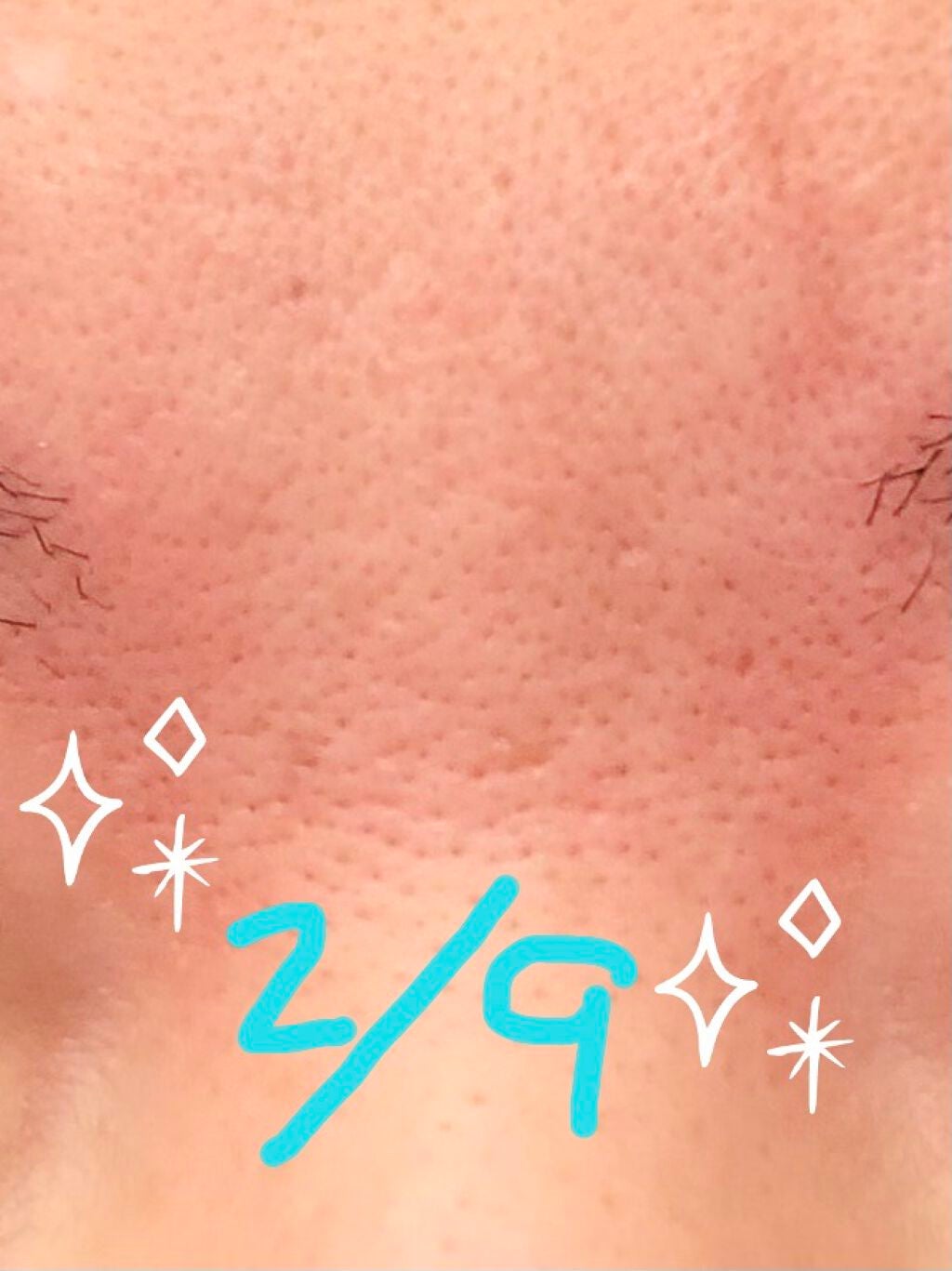 アイゾーンクリーム/B.A/アイケア・アイクリームを使ったクチコミ(2枚目)