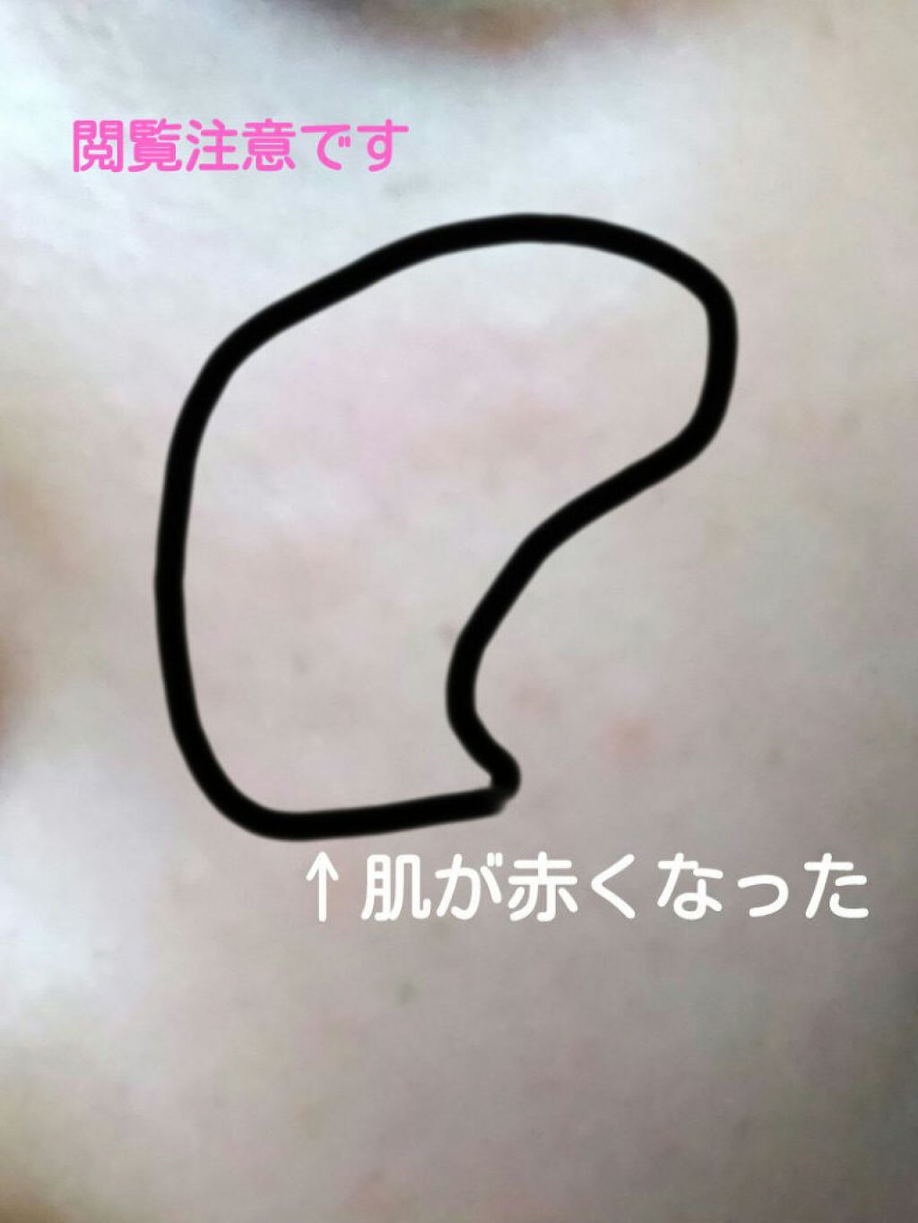 薬用しみ対策 美白化粧水/メラノCC/化粧水を使ったクチコミ（1枚目）