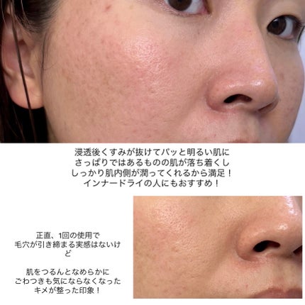 PHセンシティブマスク ポアフィット/SAM'U/シートマスク・パックを使ったクチコミ(9枚目)