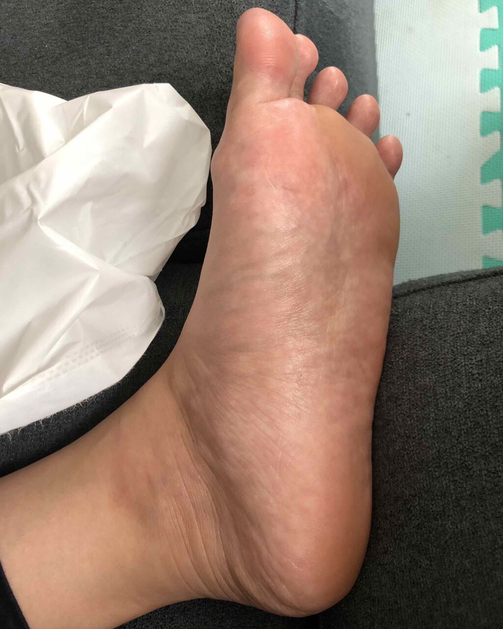 足用集中保湿パック/ドクター・ショール/レッグ・フットケアを使ったクチコミ(5枚目)