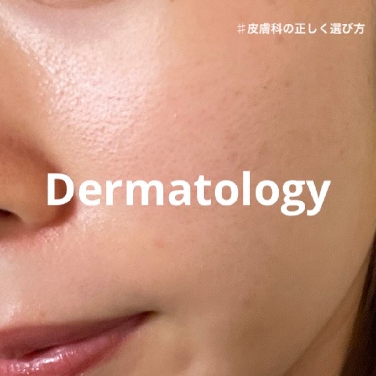 薬用 しみ 集中対策 美容液/メラノCC/美容液を使ったクチコミ(1枚目)