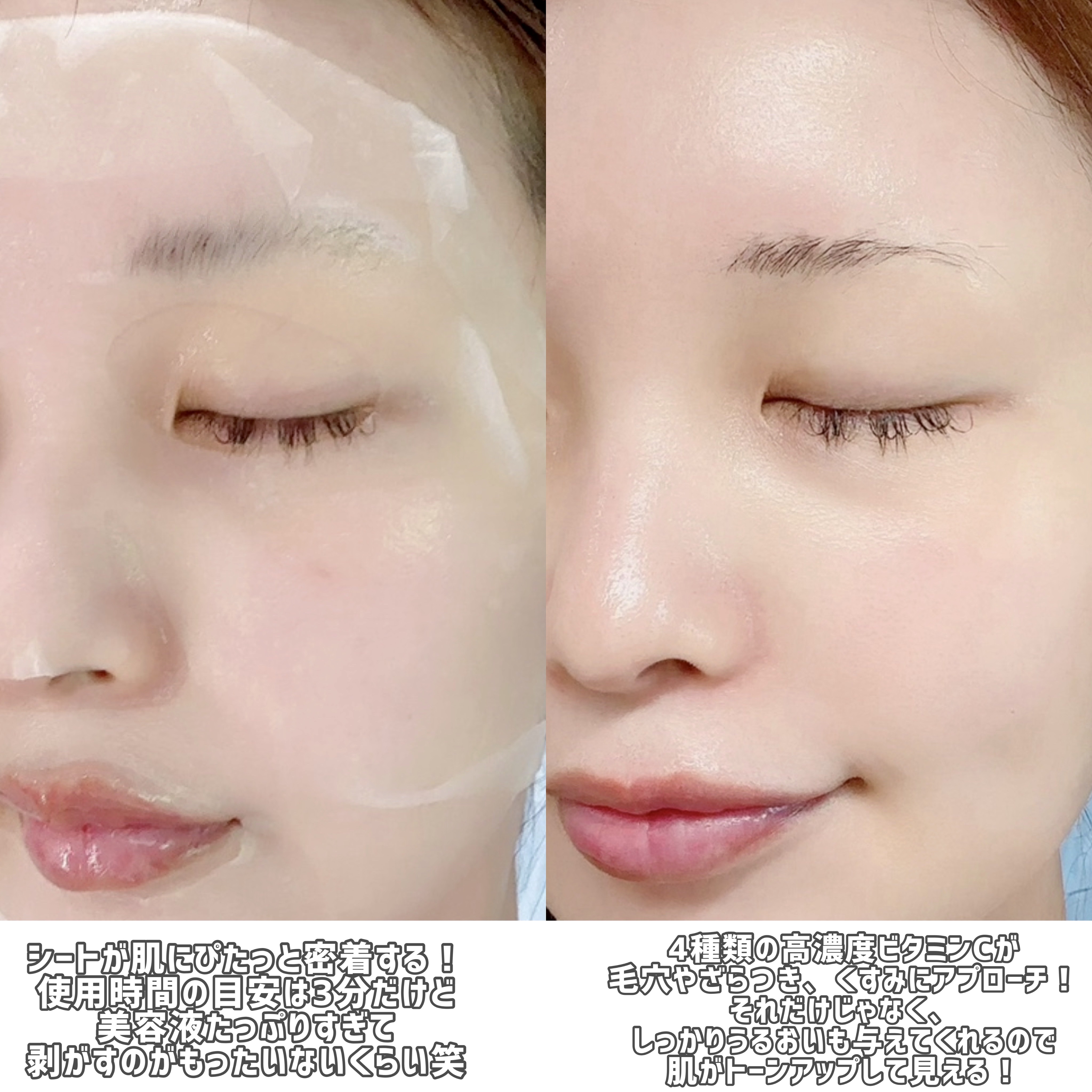 ダーマレーザースーパーVC100マスク/クオリティファースト/シートマスク・パックを使ったクチコミ（3枚目）