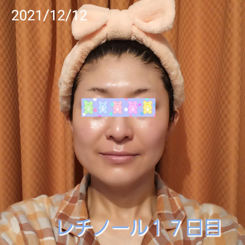 モイスチャーバーム ジャー/キュレル/フェイスクリームを使ったクチコミ（1枚目）