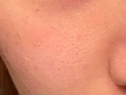 ハトムギ保湿ジェル(ナチュリエ スキンコンディショニングジェル)/ナチュリエ/美容液を使ったクチコミ(4枚目)