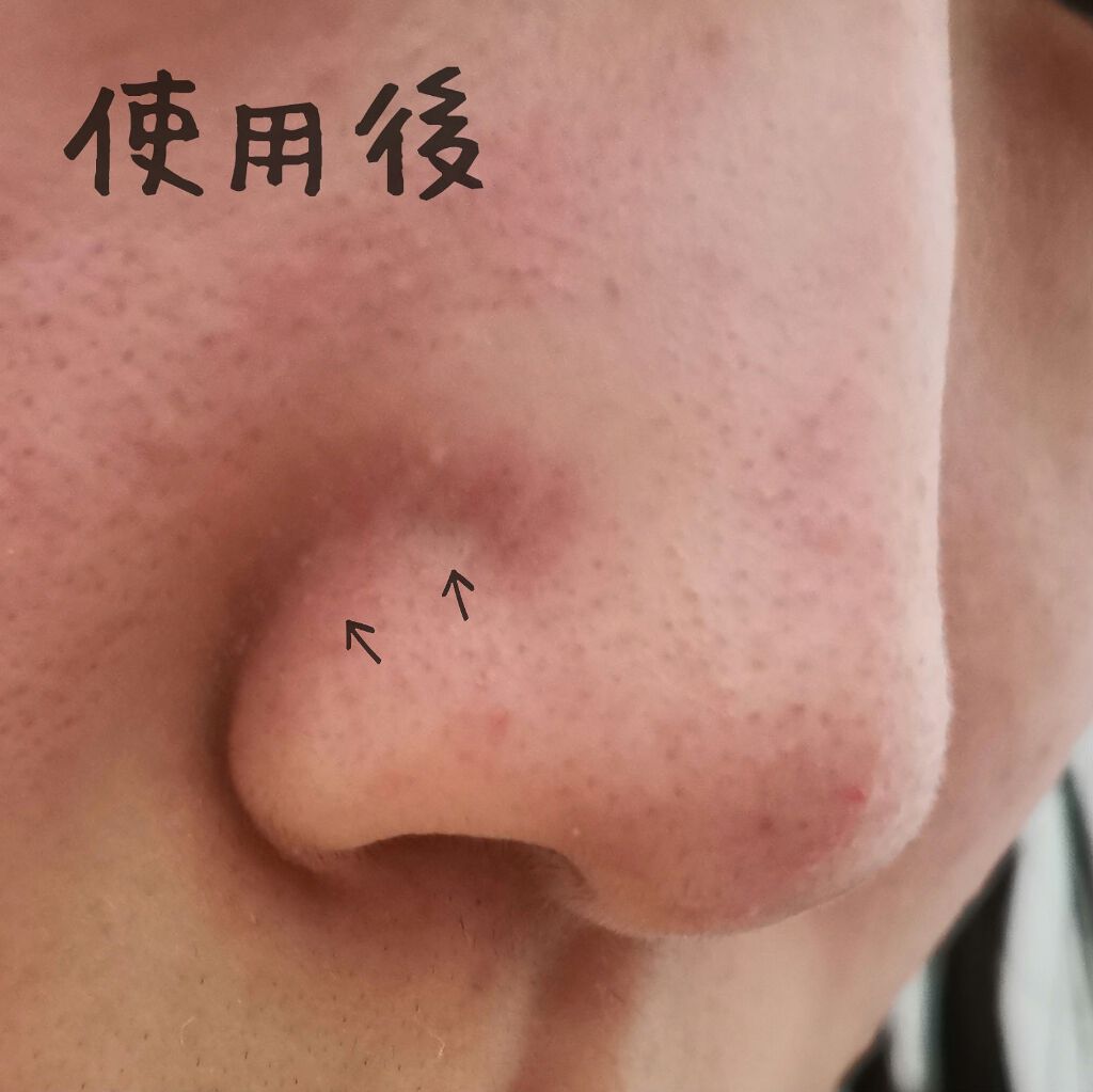 ベビーオイル ナチュラル/DAISO/ボディオイルを使ったクチコミ(4枚目)