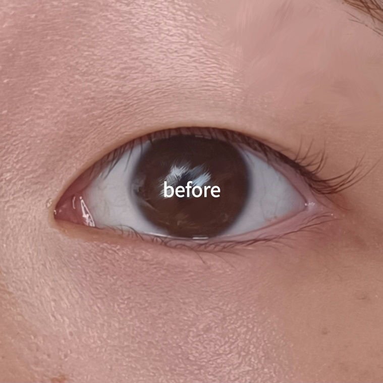 ふたえテープ 目立たず肌になじむ絆創膏タイプ/DAISO/二重まぶた用アイテムを使ったクチコミ（2枚目）