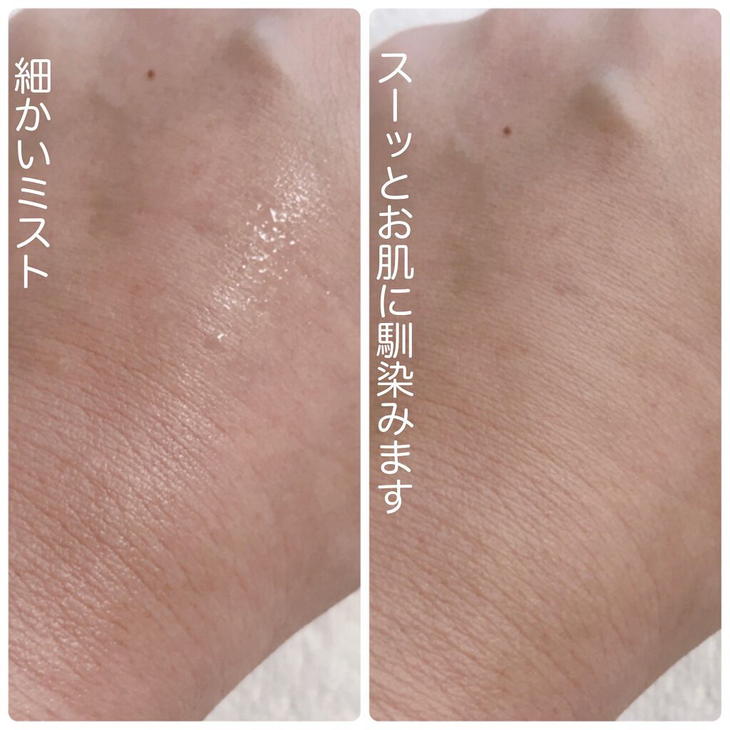 レッドシカボディミスト/MEDICUBE/その他を使ったクチコミ（3枚目）