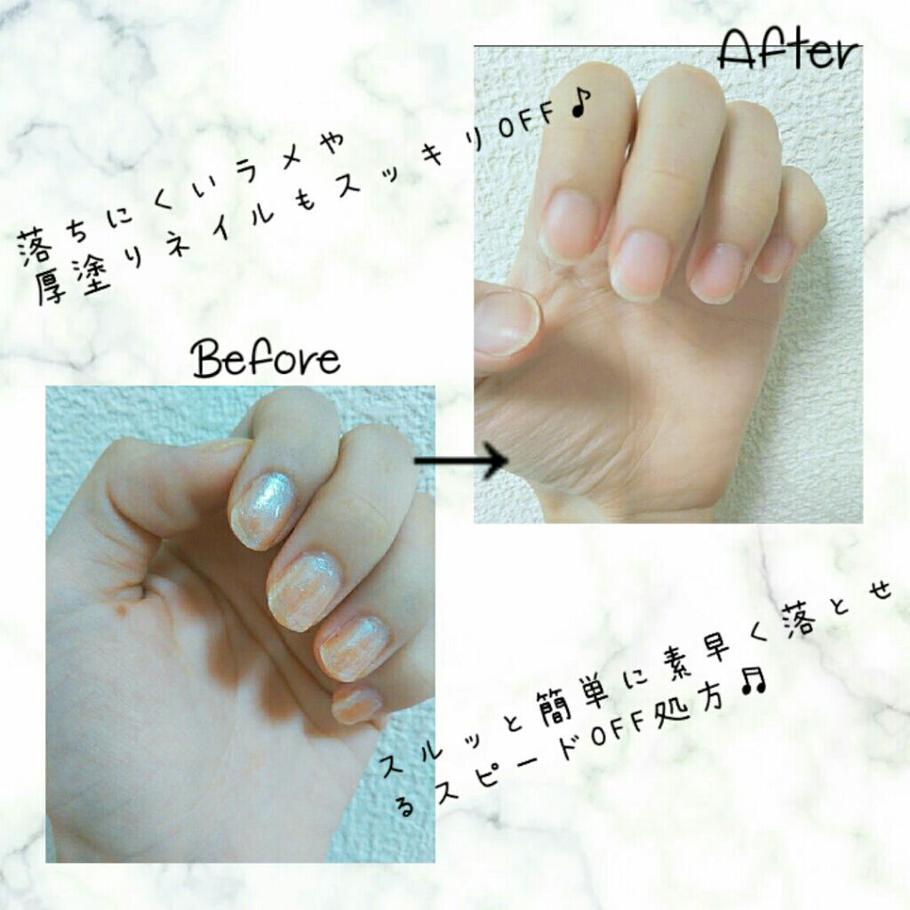 クイック＆イージーリムーバー/キャンメイク/除光液を使ったクチコミ（2枚目）