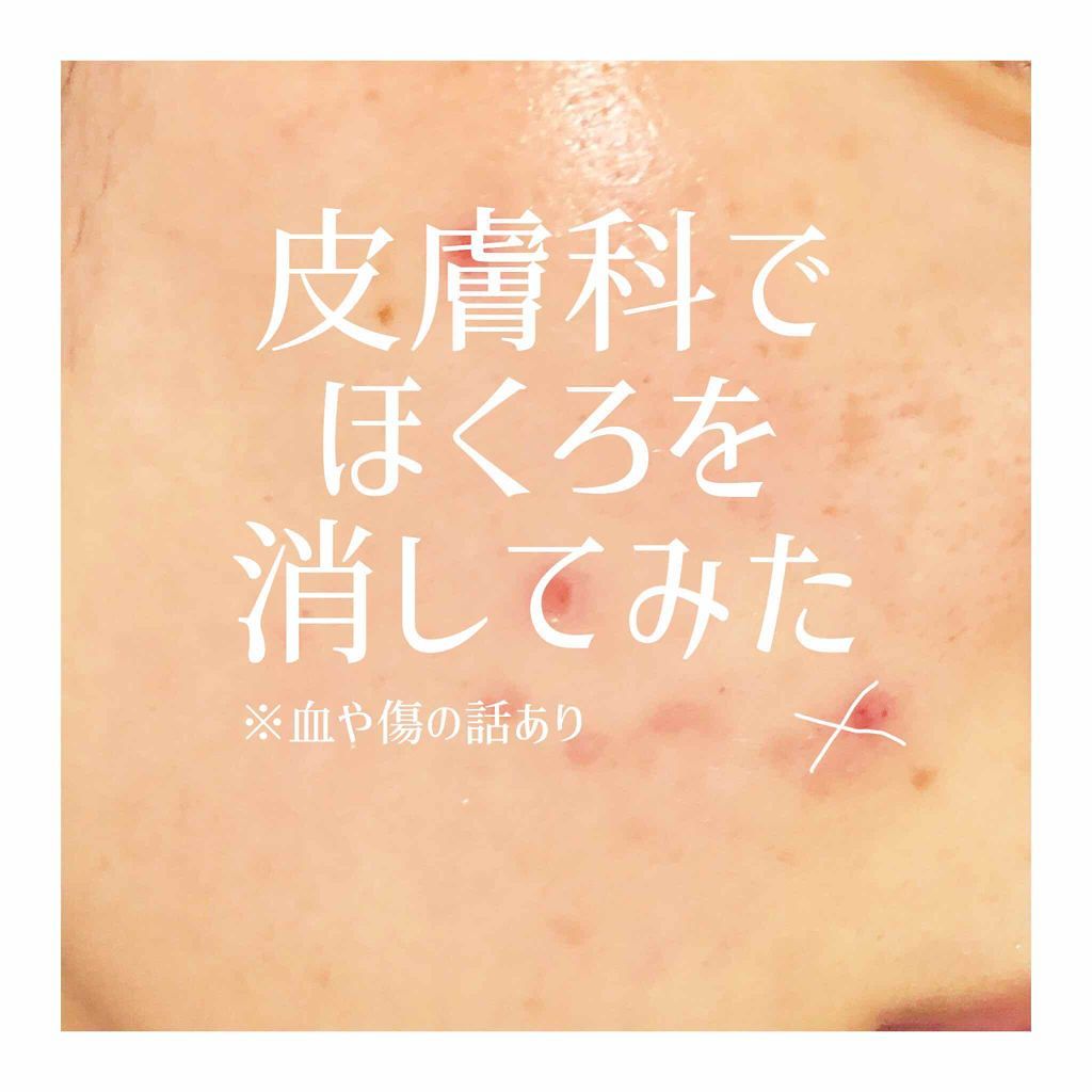 テラ・コートリル 軟膏(医薬品)/ジョンソン・エンド・ジョンソン/その他を使ったクチコミ（1枚目）