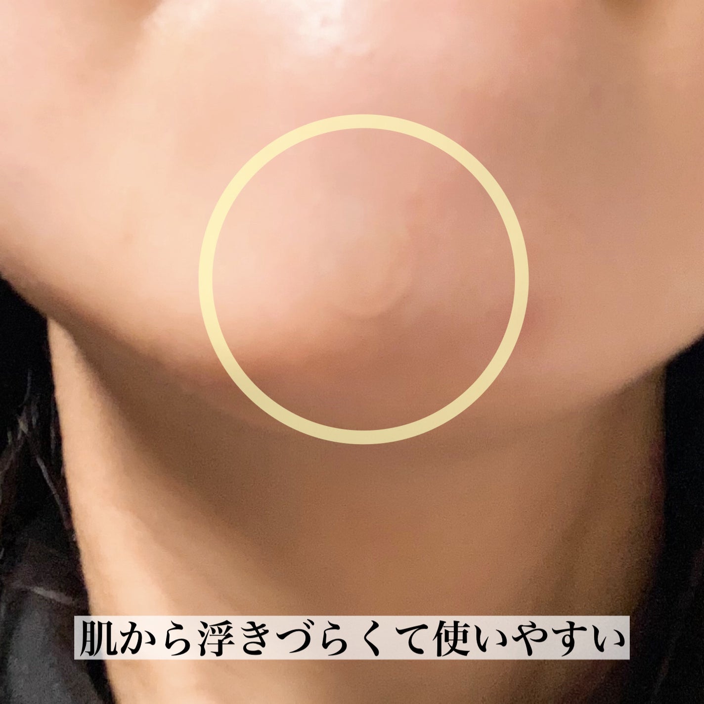 ビューティー スポットパッチ/イージーダムビューティー/にきびパッチを使ったクチコミ(5枚目)