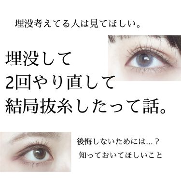 二重整形の口コミ 埋没考えてる人は見てほしい 私が埋没を2度 By ぐば子のお道具箱 乾燥肌 Lips