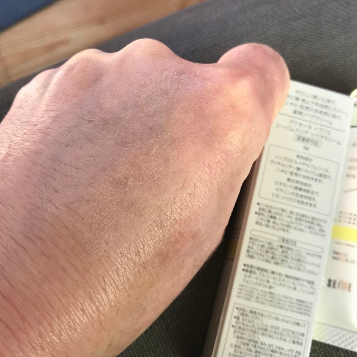 イプノス シーバムクリア リペアクリーム/ACSEINE/フェイスクリームを使ったクチコミ(2枚目)