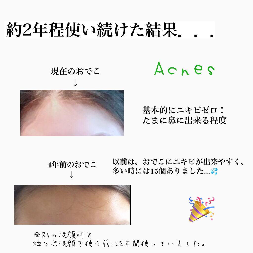 メンソレータム アクネス 薬用毛穴すっきり粒つぶ洗顔 - 洗顔料