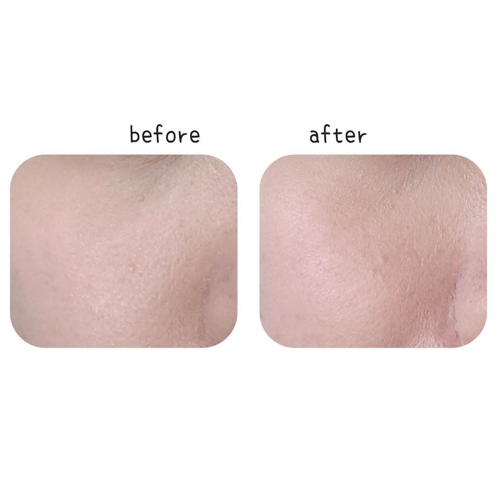 アレルバリア エッセンス BB N/d プログラム/BBクリームを使ったクチコミ(2枚目)