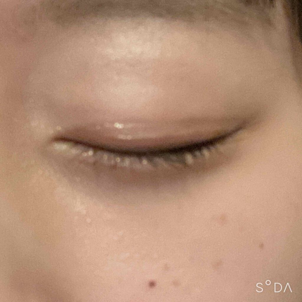 のびーるアイテープ（絆創膏タイプ、レギュラー）/DAISO/二重まぶた用アイテムを使ったクチコミ（3枚目）