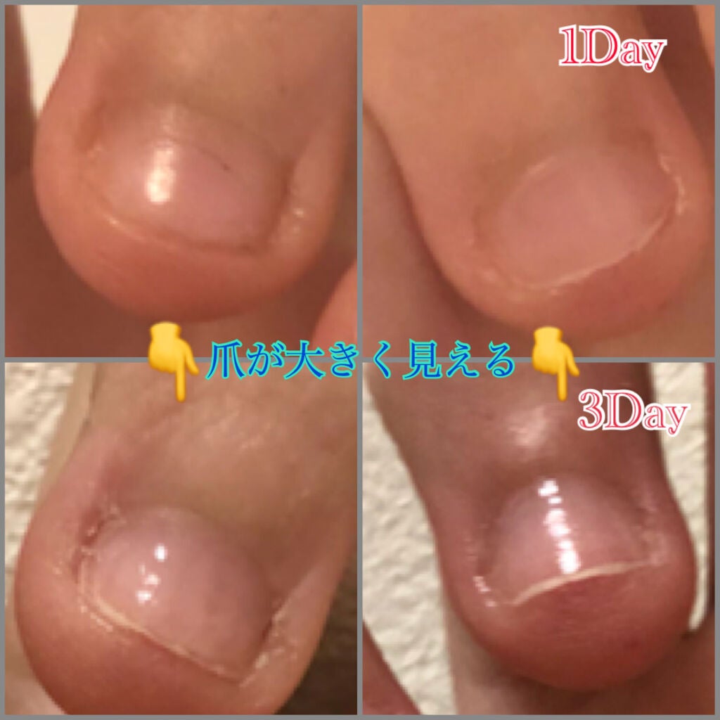 角層まで浸透する うるおいミルク 無香料/ビオレu/ボディミルクを使ったクチコミ(4枚目)