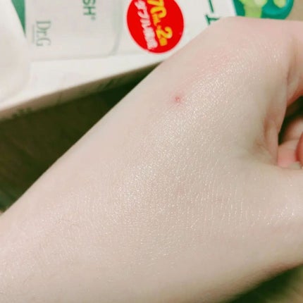 レッドブレミッシュ クリアスージングクリーム/Dr.G/フェイスクリームを使ったクチコミ(6枚目)