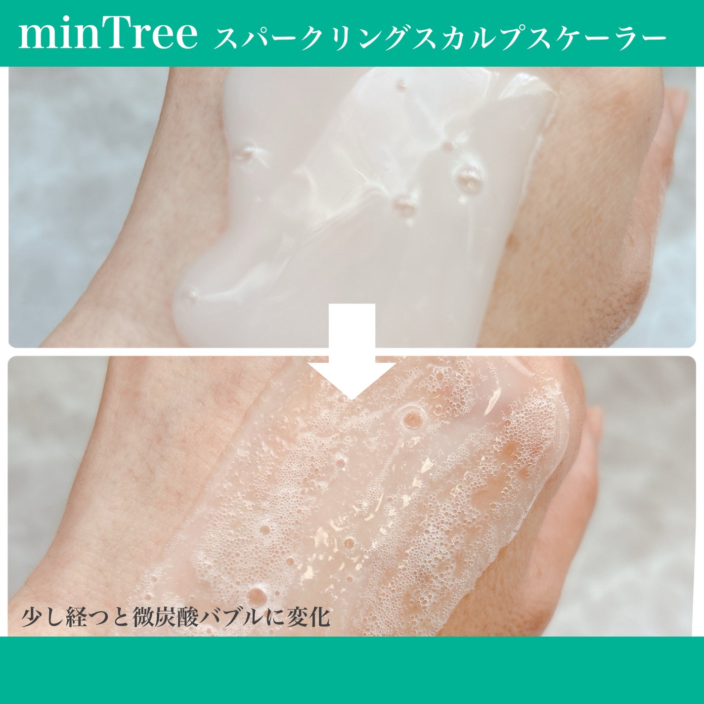 スパークリングスカルプスケーラー/ミンツリー/頭皮ケアを使ったクチコミ(4枚目)