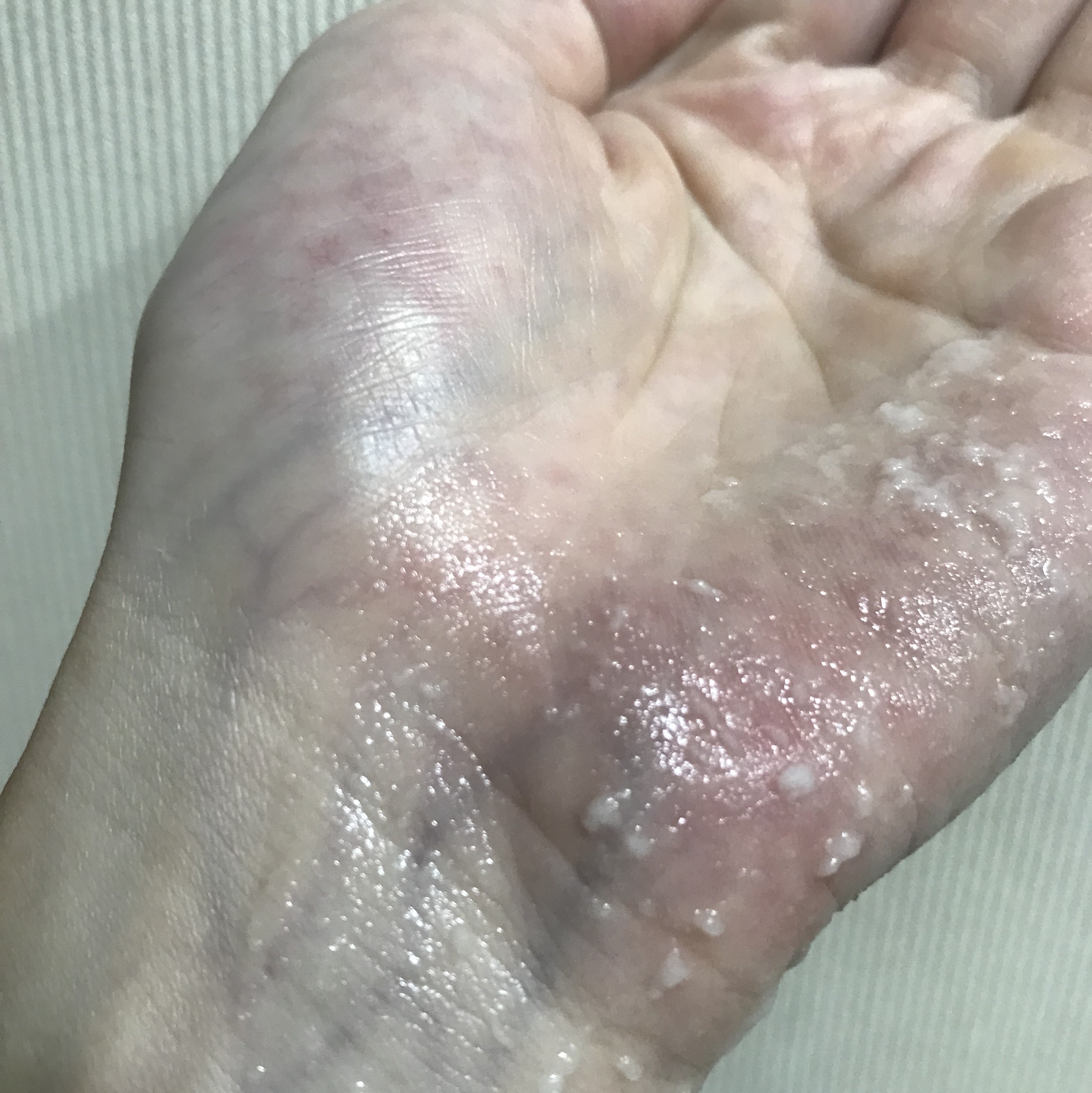 ブライトニングピーリングジェル/Dr.G/ピーリングを使ったクチコミ（3枚目）