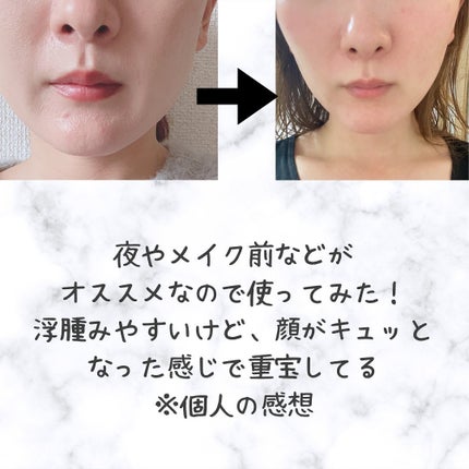 chinami♡美容好きな管理栄養士/福岡 on LIPS 「rejuup美容液医師が認めた30秒で体感できるNMN※xヒト..」(4枚目)