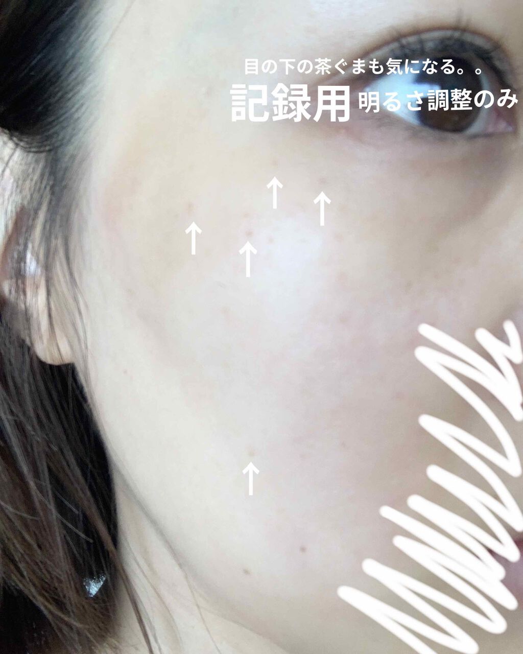 EUKROMA　ハイドロキノンクリーム4%　20g/EUKROMA/その他スキンケアを使ったクチコミ（2枚目）