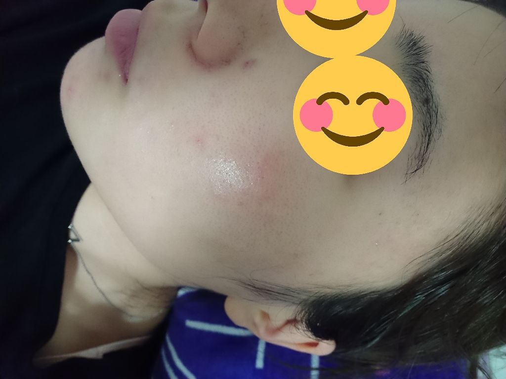 ハトムギ化粧水(ナチュリエ スキンコンディショナー R )/ナチュリエ/化粧水を使ったクチコミ（2枚目）