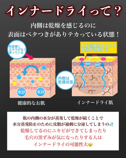 潤浸保湿 フェイスクリーム/キュレル/フェイスクリームを使ったクチコミ(2枚目)