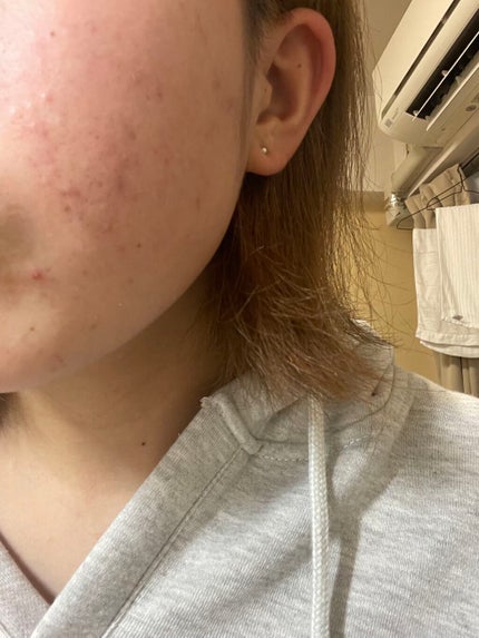 を使ったクチコミ(2枚目)