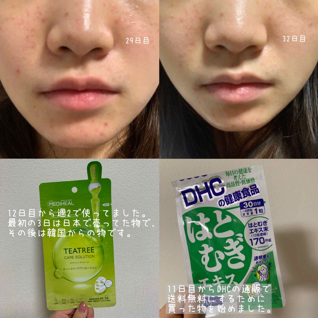 DHC はとむぎエキス/DHC/健康サプリメントを使ったクチコミ(2枚目)