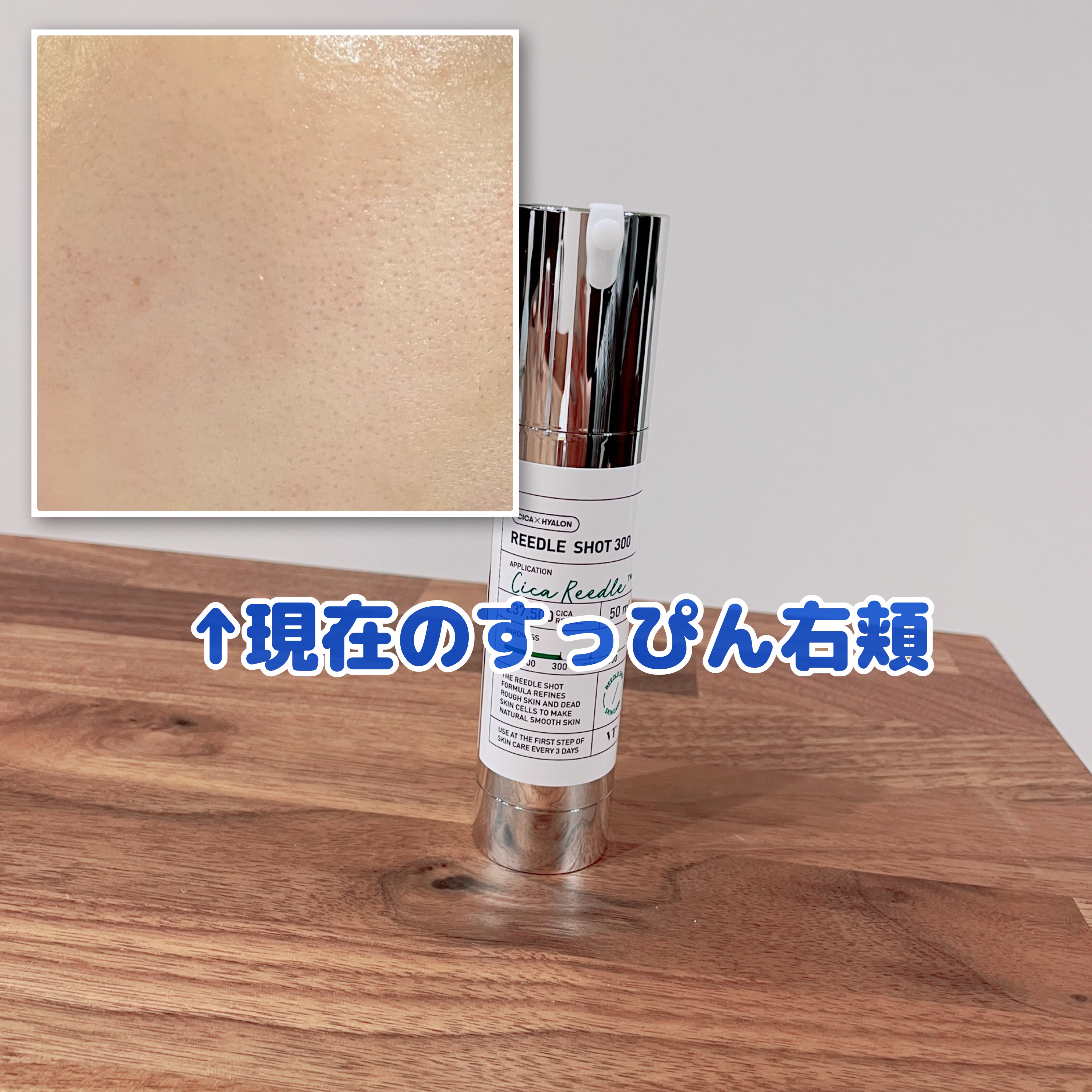 リードルショット300/VT/美容液を使ったクチコミ（2枚目）