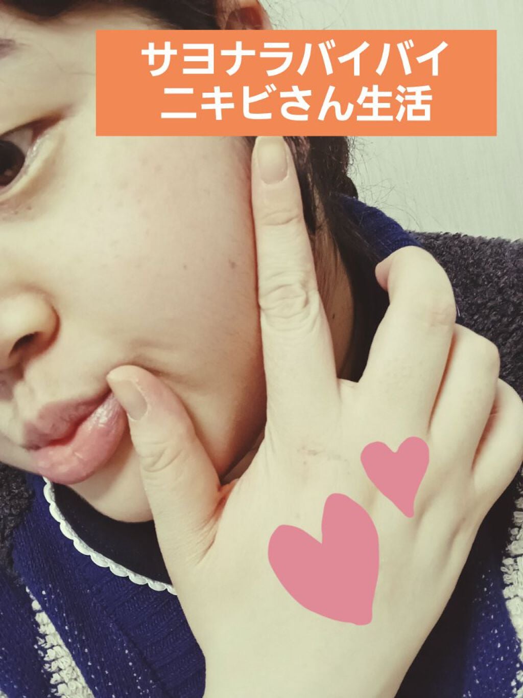 空良 on LIPS 「ニキビさんとおさらば!会う度に肌綺麗✨✨と絶賛されるアラサー女..」(1枚目)