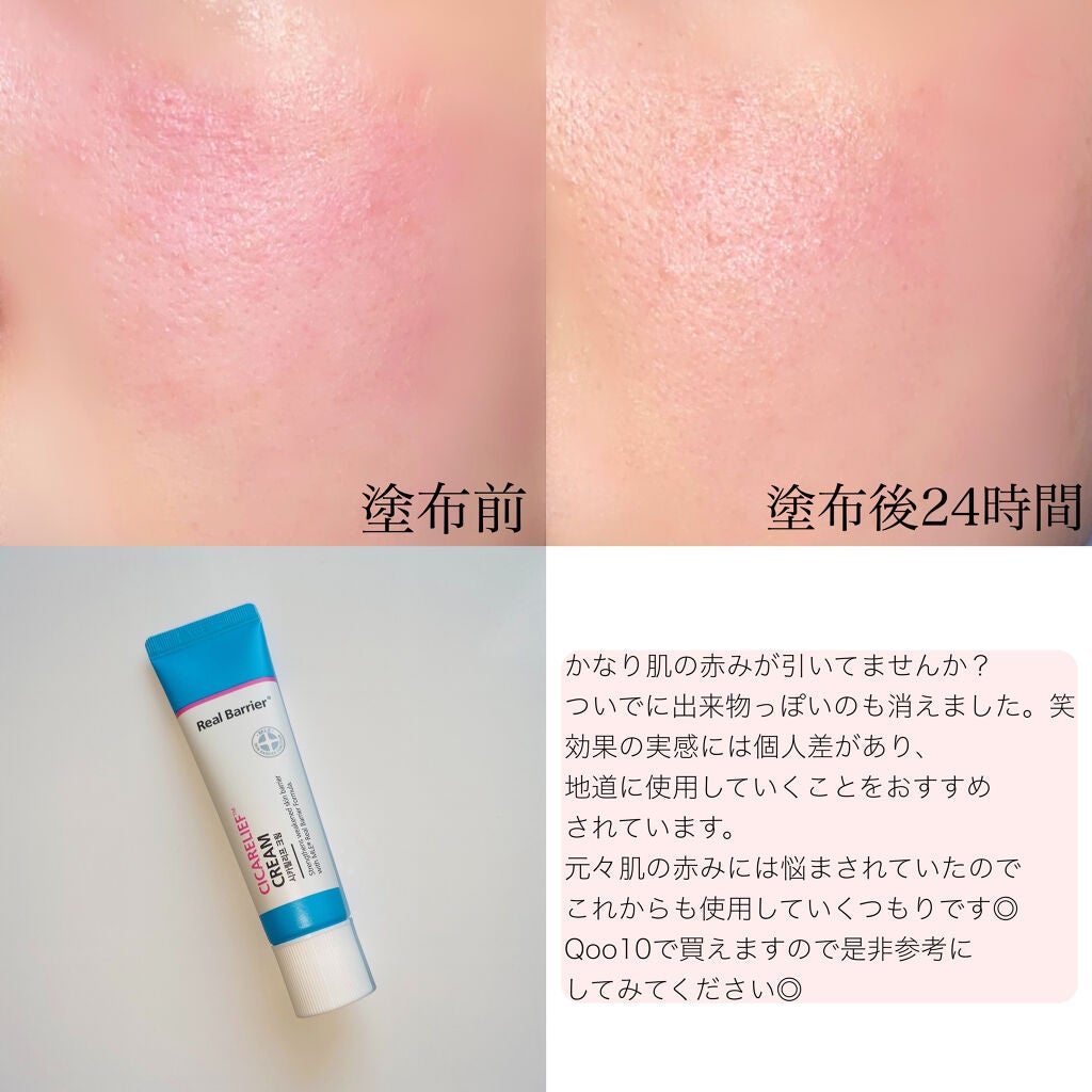シカリリーフクリーム/Real Barrier/フェイスクリームを使ったクチコミ(3枚目)