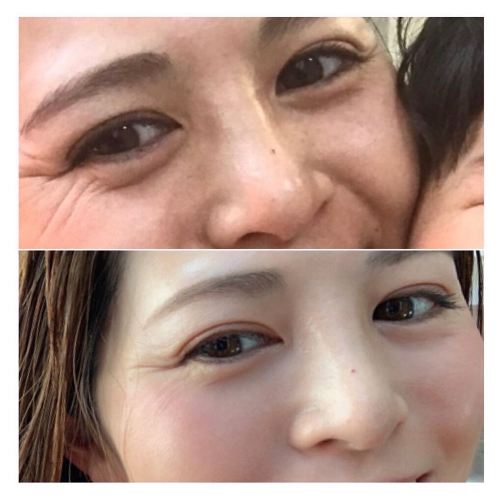 スキンケア/肌改善/yukari.Oka on LIPS 「メイク以外でツヤ肌になる方法ツヤ肌になりたい場合2つの方法があ..」(9枚目)