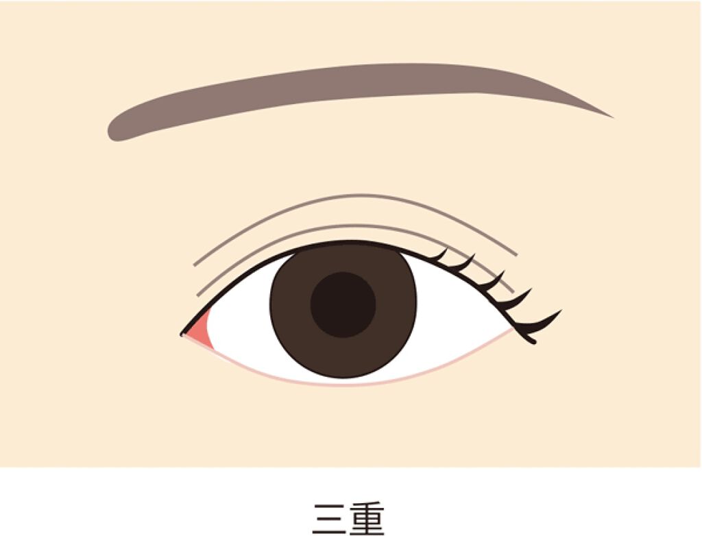 ゆま on LIPS 「こんにちは(๑・㉨・๑)ゆまです。今回は、三重まぶたの解消法を..」(2枚目)