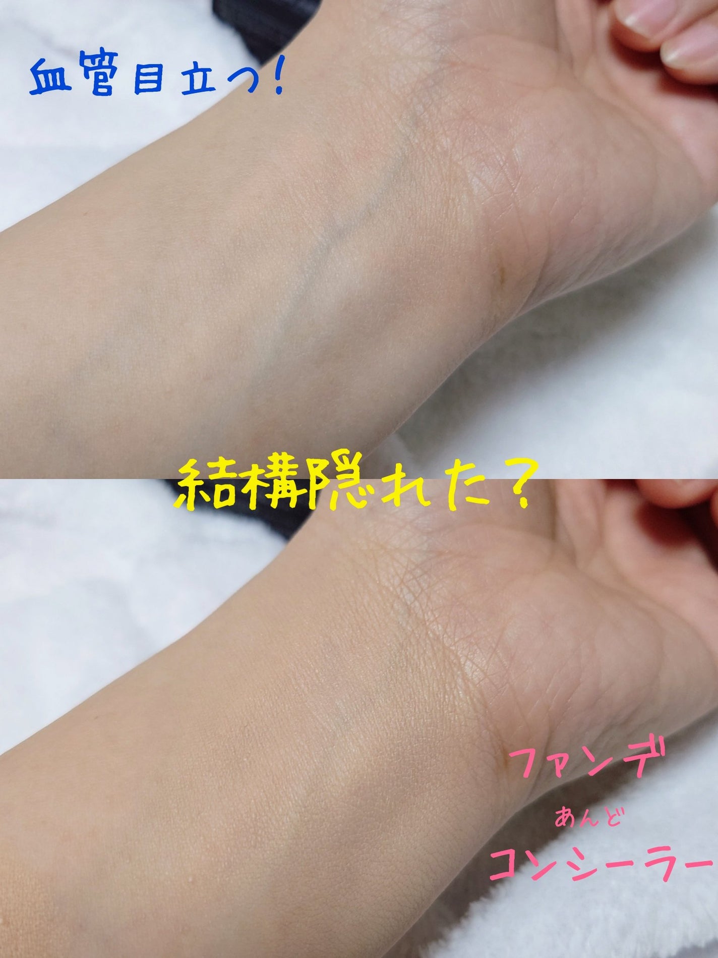 リアル フローレス ウェイトレス パーフェクティング コンシーラー/ローラ メルシエ/リキッドコンシーラーを使ったクチコミ(4枚目)