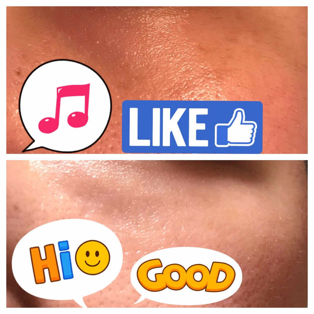 クラリファイング ローション 1/CLINIQUE/拭き取り化粧水を使ったクチコミ（2枚目）