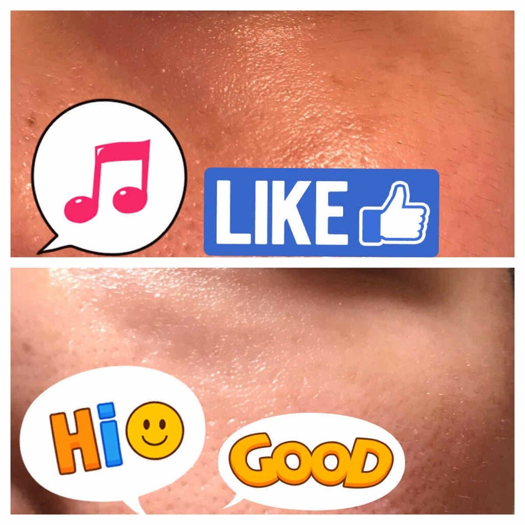 クラリファイング ローション 1/CLINIQUE/拭き取り化粧水を使ったクチコミ(2枚目)