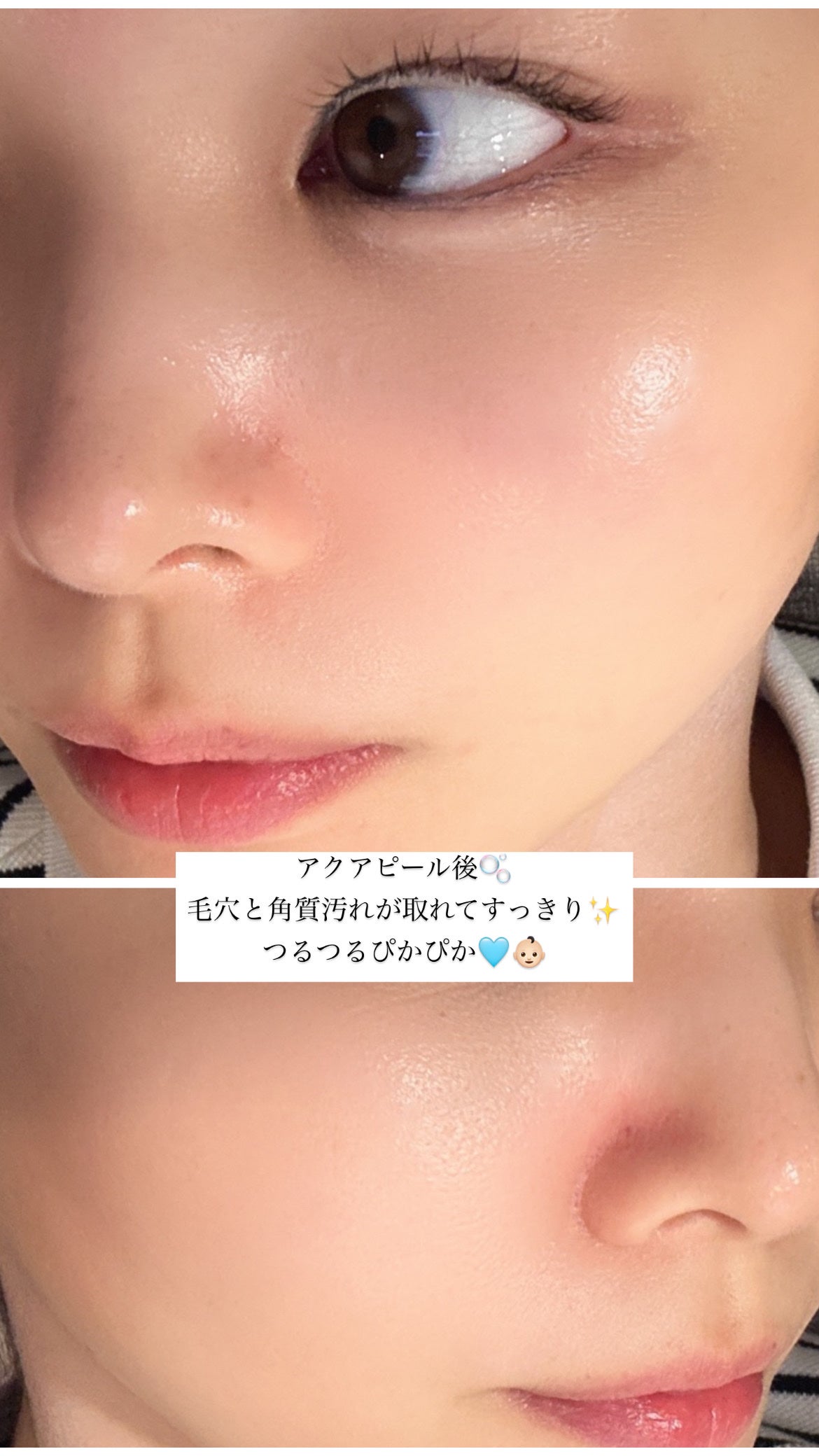 ãããð몚몚칎 on LIPS ãæž¡éåå¿è
ð°æ¥æ¬äººã«ããããçŸå®¹ã¯ãªããã¯ãã§ã³ãã OKæŽåœ¢å€..ãïŒ2æç®ïŒ