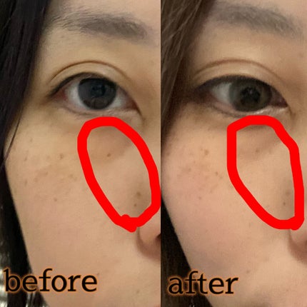 ææèçšè¬çšçŸçœçŸå®¹æ¶²/ç¡å°è¯å/çŸå®¹æ¶²ã䜿ã£ãã¯ãã³ãïŒ3æç®ïŒ